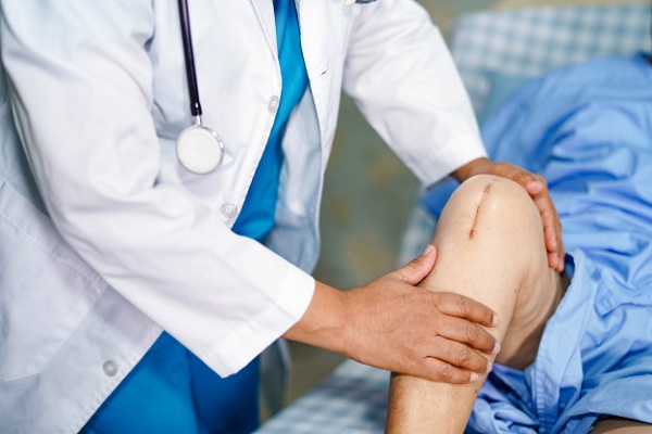 What is a Total Knee Replacement?